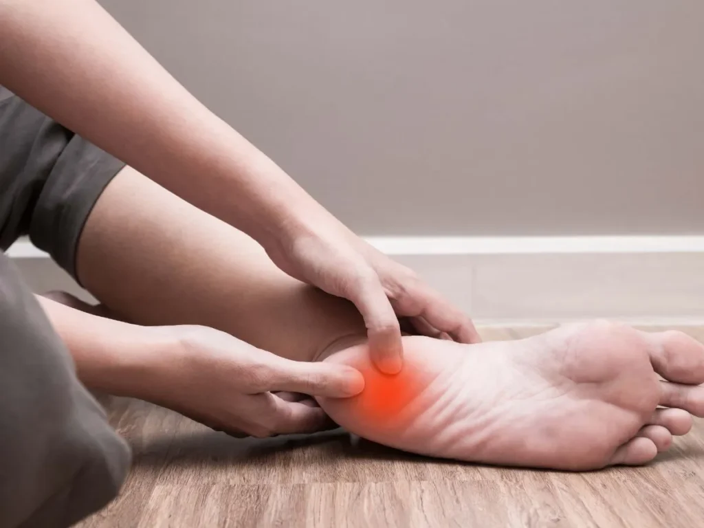Plantar Fasciitis